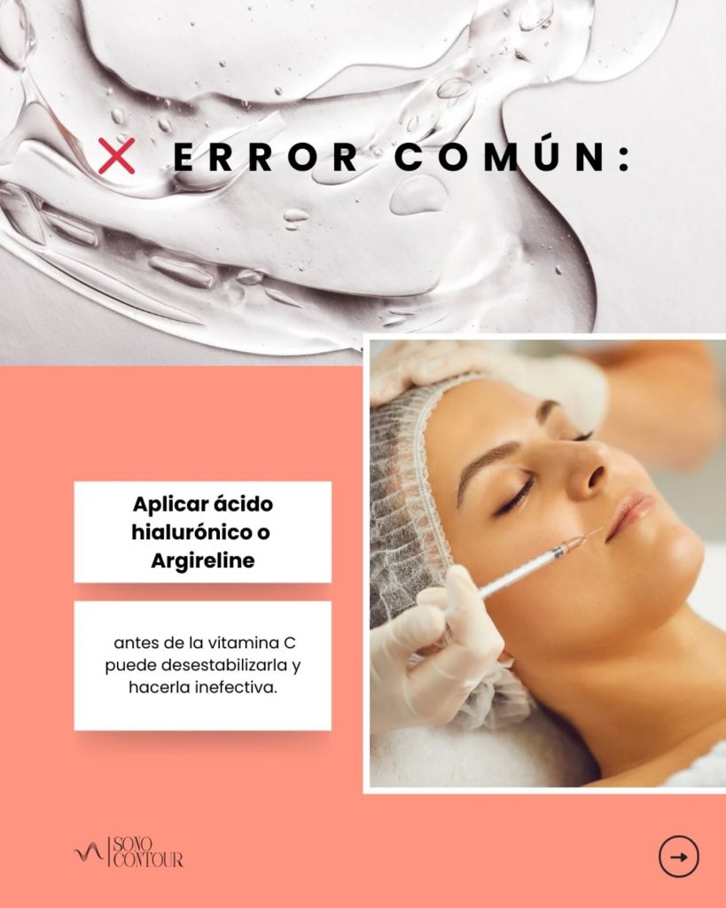 Sono Contour1